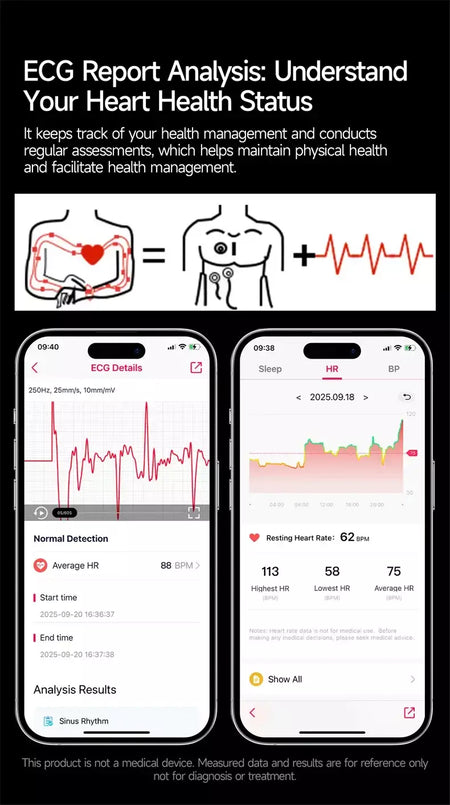 2026 novo relógio inteligente masculino feminino exame micro-físico ecg + ppg oxigênio no sangue ácido úrico pressão arterial safira smartwatch masculino